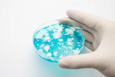Mantar miselyum petri kabı. Petri kabında büyüyen mikoloji. Agar 'da mantar miselyumu. Reishi mantarı miselyumu patates dekstroz agar üzerinde. Beyaz arka plan. Laboratuvar aksesuarları.