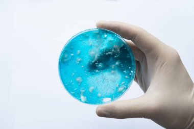 Laboratuvar aksesuarları. Beyaz arka plan. Mantar miselyum petri kabı. Petri kabında büyüyen mikoloji. Agar 'da mantar miselyumu. Reishi mantarı miselyumu patates dekstroz agar.
