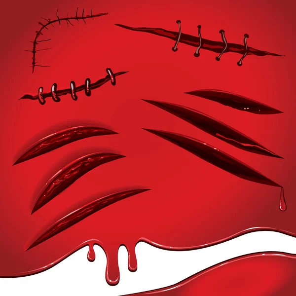 Cicatrices et égratignures cousues de sang — Image vectorielle
