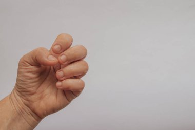 Kısa tırnakları yenmiş bir kadın eli ve beyaz bir arka planda kuru tırnak eti. Sağ tarafında büyük kopya alanı olan profesyonel maniküre ihtiyaç duyan dağınık tırnakların yakın çekimi..