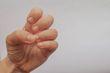 Kısa tırnakları yenmiş bir kadın eli ve beyaz bir arka planda kuru tırnak eti. Sağ tarafında büyük kopya alanı olan profesyonel maniküre ihtiyaç duyan dağınık tırnakların yakın çekimi..