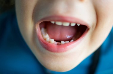 Yeni düşmüş bir dişi ve ağzı açık bir çocuk.