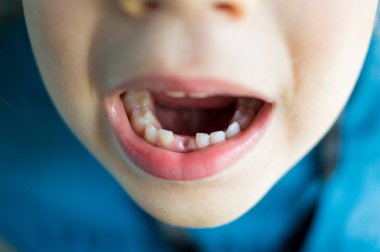 Çocuk dişini gösteriyor.