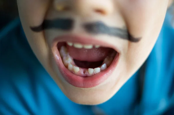 Bıyıklı ve mavi tişörtlü, dişini yeni kaybetmiş bir çocuğun yakın çekimi.