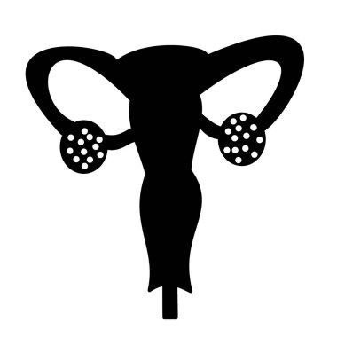 Her iki yumurtalık hastalığında da çok sayıda kist olan polisistik yumurtalık sendromu dişisi.