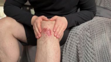 Bir adam dairesinde otururken dizinden yaralanmış bir adama bakıyor. Küçük bir yara bakımı ve kapalı alandaki küçük bir kazaya insani tepki. Her gün gerçekçiydi..