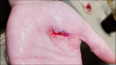 Görünür kanaması olan bir insanın elindeki taze kesiği kapat. Hafif yaralanma ve deri hasarı konsepti. Tıbbi acil durum, ilk yardım, kaza ve sağlık geçmişi.