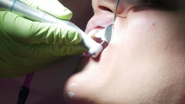 Ortodoncista Eliminación Pegamento Los Dientes Después Retirar Los Soportes — Vídeos de Stock