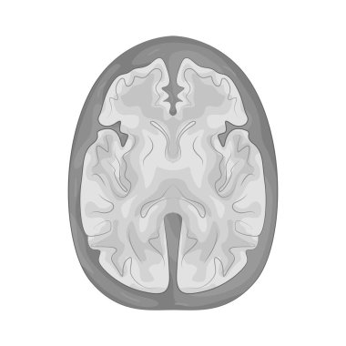 Beyin röntgeni, kafatası ve kafanın yapılarını görüntülemek için radyasyon kullanan bir görüntüleme testidir..
