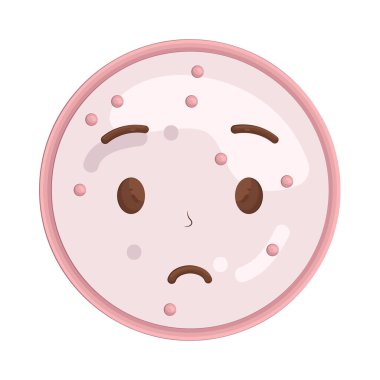 Sivilce, gözeneklerin yağ, bakteri ve ölü deri hücreleriyle iltihaplandığı bir cilt hastalığıdır..