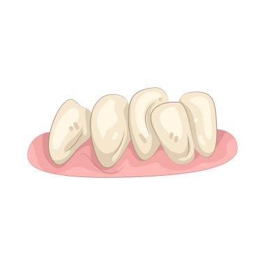 Dişler düzensiz ya da düzensiz diş konumlandırmasına işaret eder.