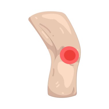 Diz ağrısı ya da diz ekleminde hissettiğin ağrı..