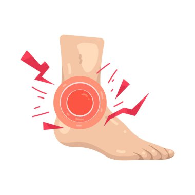 Ayak bileği ağrısı ya da bilek ekleminde hareket ve dengeyi etkileyen iltihaplanma..