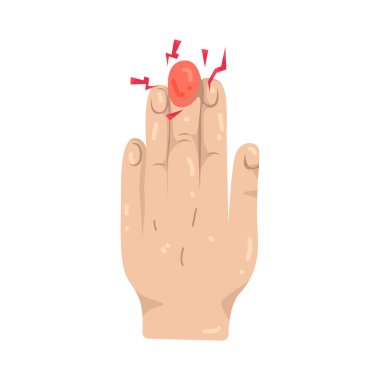 Parmak ağrısı, parmak eklemlerindeki rahatsızlıktır. Bu da kavramayı ve hareket kabiliyetini etkiler..