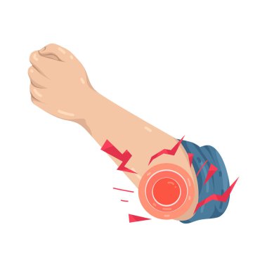 Dirsek ağrısı, dirsek eklemindeki iltihaplanma ya da ağrıdır. Genellikle tekrarlanan hareketlerden kaynaklanır..