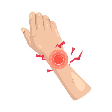 Bilek ağrısı, el ve el hareketlerini etkileyen bilek eklemlerindeki tahriş ya da yaralanmadır..