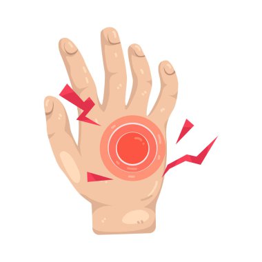 El ağrısı, el eklemlerindeki gerginlik ve eklem iltihabından kaynaklanan sertliğe işaret eder..