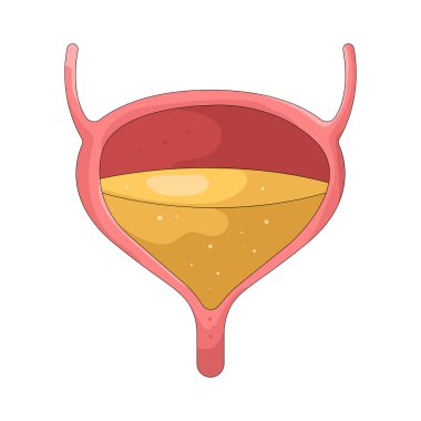İnsan mesanesi elemeden önce idrar depolayan içi boş bir organdır..