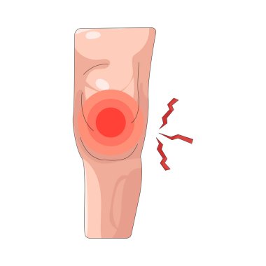 Diz ekleminde ağrı yaralanma, iltihap ya da yıpranma kaynaklı..