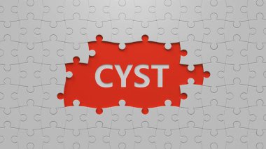 Kist kelimesinin eksik olduğu yapboz parçaları. Özen kavramı. Yapboz parçalarını eksik parçalarla kapat. İş Konsepti 3D görüntüleme..