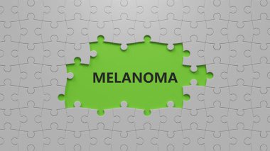 El, içinde melanom olan parçaların eksik olduğu bir yapboz parçası koyuyor. Kelime, kayıp parçalarla birlikte yapboz parçaları üzerine yazılmış. Yapboz parçalarını, eksik parçalarla kapatıyoruz. İş Konsepti 3D görüntüleme..