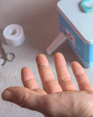 Arka planda küçük bir kesik ve ilk yardım çantasıyla yaralı bir parmağın yakın çekimi. Yara bakımı ve aile içi tedavi kavramı