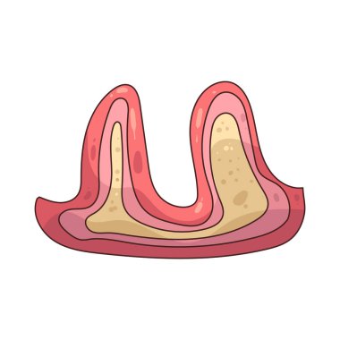 Diş problemi çürüme, enfeksiyon ya da hassasiyet gibi diş eti, diş eti ya da ağız gibi herhangi bir sorunu ifade eder..