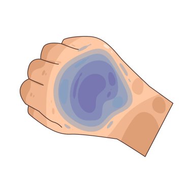 Çürük, yüzeyin altındaki kanamadan kaynaklanan bir renk değişimidir..