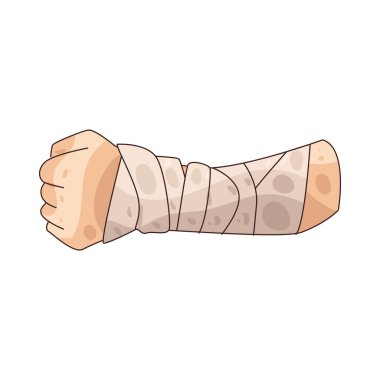 Bandajlı bir el yaralanması enfeksiyonu önlemek için kapalı bir el yarası gösteriyor..