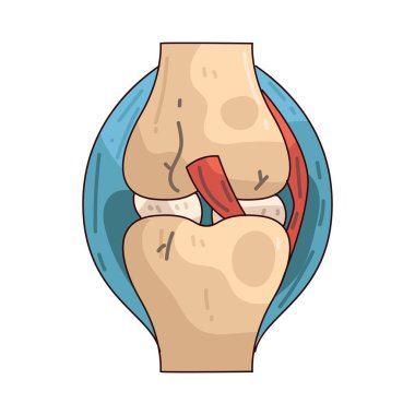 Eklem ağrısı, iltihaplanma, yaralanma, yıpranma ya da yıpranma kaynaklı eklem ağrısıdır..