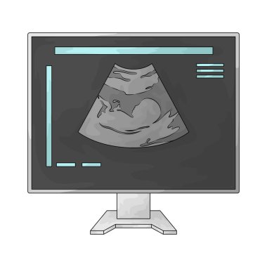 Sonografi, ultrason dalgalarını kullanarak iç organları görselleştirmek için kullanılan bir tıbbi görüntüleme metodudur..