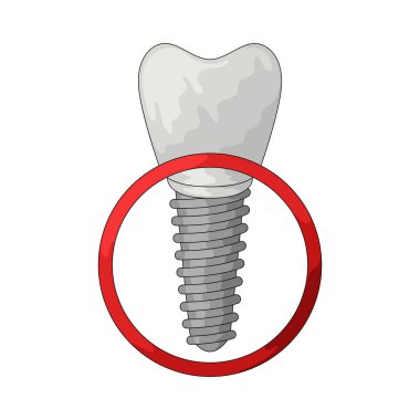 Diş implantı, yeni bir dişi desteklemek için cerrahi müdahaleyle yerleştirilen metal bir çubuktur..