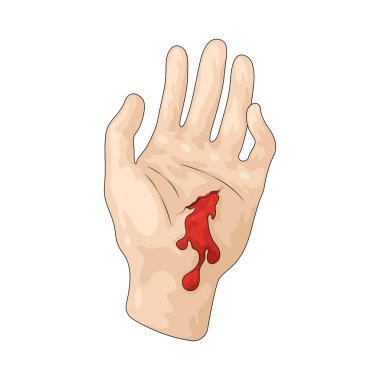 Kanama, yaralanma nedeniyle vücuttaki kan kaybıdır..