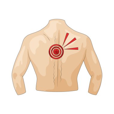 Sırt ağrısı, hareket ve duruşu etkileyen üst, orta ya da alt sırttaki rahatsızlık ya da sertliktir..