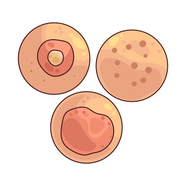 Deri sorunları akne, tahriş ya da enfeksiyon gibi çeşitli dermatolojik durumlara işaret eder..