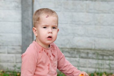 Serin bir günde arka bahçede oynadıktan sonra endişeli bir ifadeye sahip küçük bir çocuk.