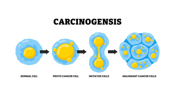 Carcinogenesis process development from genetic changes or mutation, doubling to cell division. Labeled Proto-cancer,initiator cells,malignant cancer cells. Mutagenesis, tumorigenesis. Tumor formation