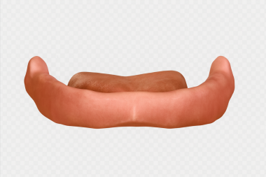 edentulous alt çene implant yok