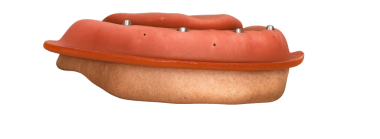 Alt protezin alt kısmı için implantlar, resmi olarak protezin muhafaza edildiği takma diş olarak adlandırılır.