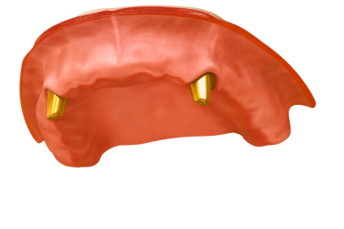 Ambar nakli / eklenti konutları Yer bulucu eklentileri