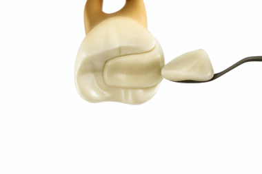 diş pekiştirme kök kanal işlemleri (restorasyonun lütfedilmesi)