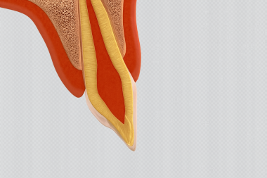 kök kanal prosedürü diş