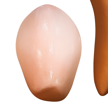 Diş püskürmesi (ağız boşluğunda diş büyümesi))