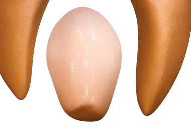 diş büyütme ortodonti