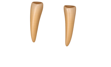 Diş implantı için diş dökülmesi.