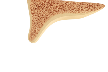 alveolar kemik çene kemik kortikal kemik