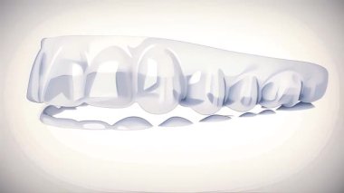 Hizalama terapisi ortodontik anime hizalayıcılarını temizle 