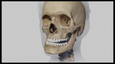 TMJ temporomandibular eklem İyi huylu Tümörler