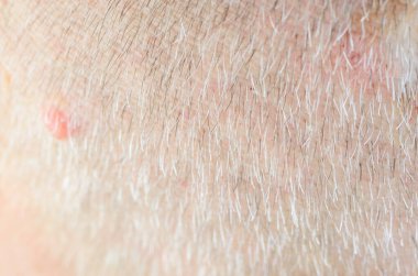 Yaşlanan cildin yakın çekim makro görüntüsü, gri saçlar ve küçük bir ben.