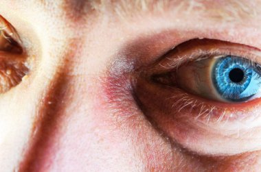 Detaylı deri dokusu ve ince saçları olan canlı mavi bir gözün aşırı yakın çekimi.